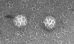 [ Clathrin-mediated vesicle formation ]